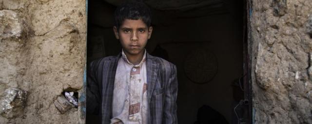 Yahya* lives in one room with his family and all their possessions. They need to walk for two hours to reach water wells, which are often contaminated by cholera. Photo: Gabreez/Oxfam Yahya* lives in one room with his family and all their possessions. They need to walk for two hours to reach water wells, which are often contaminated by cholera. Photo: Gabreez/Oxfam